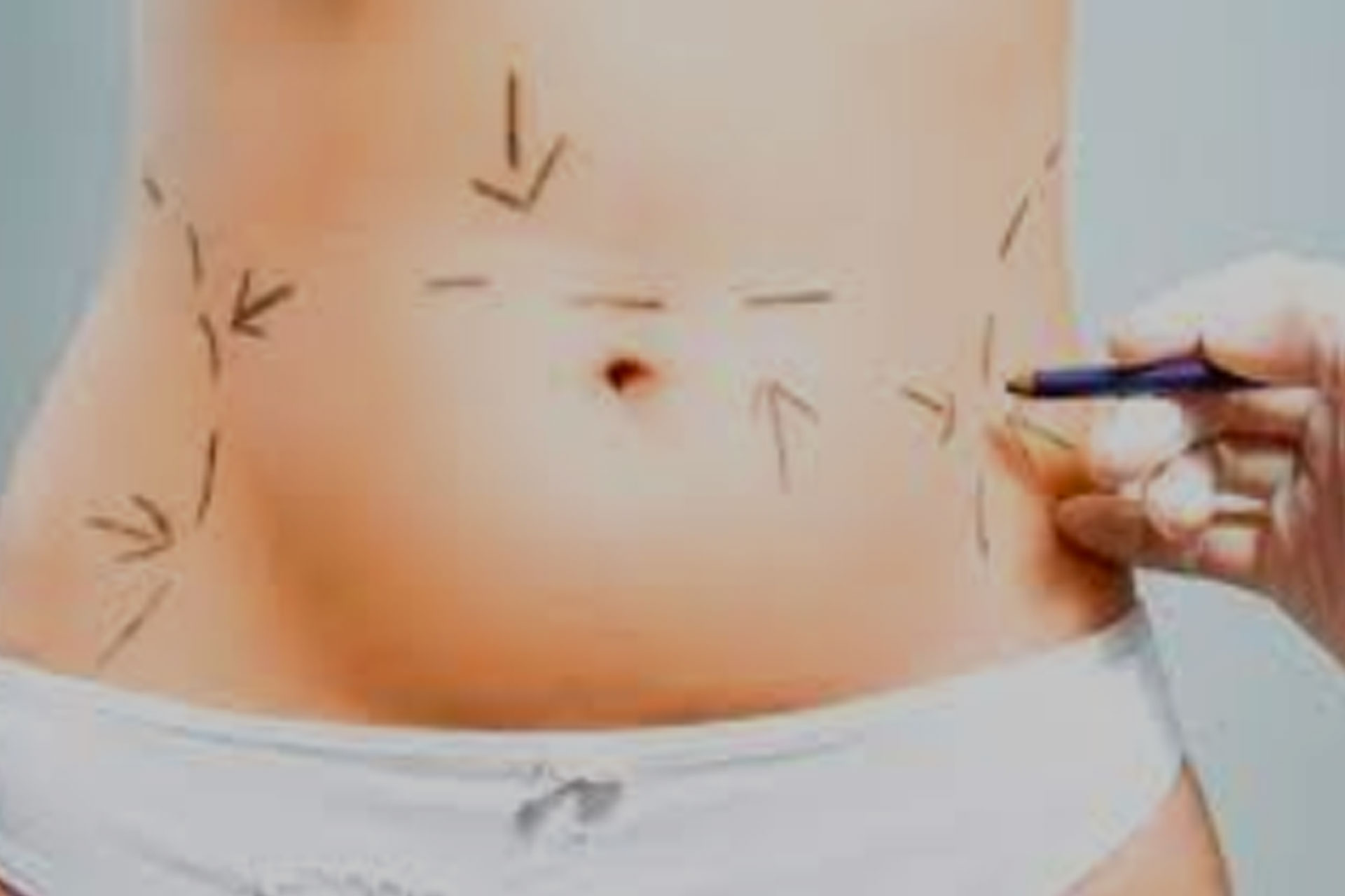 Cirugía de Abdomen. Todo lo que hay que saber…